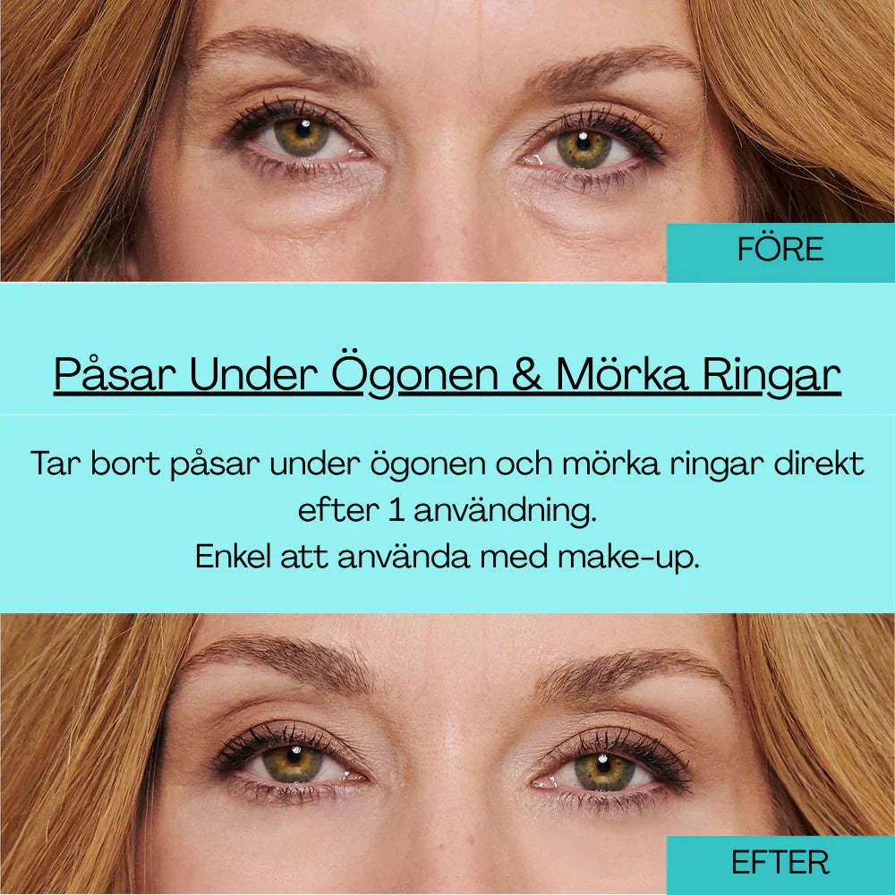 EYERISE - Slätare runt ögonen utan injektioner!